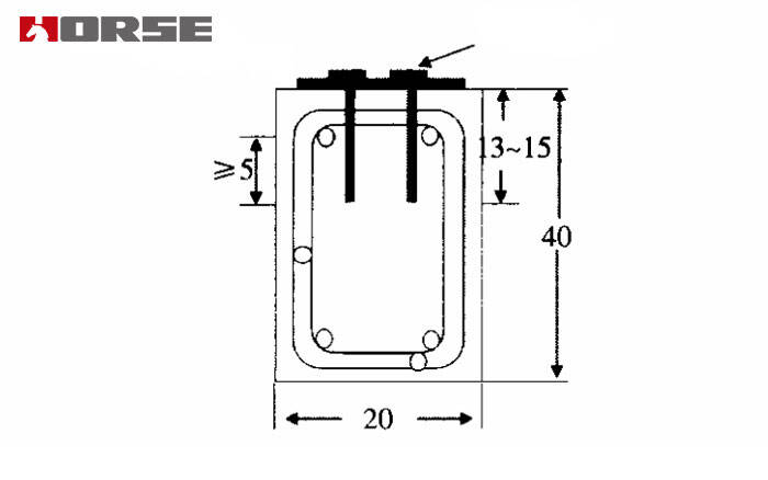 "Fibre bundle anchor" anchoring method "Fibre bundle anchor" anchoring method